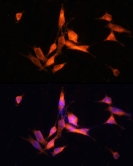 MMP10 Rabbit polyclonal antibody