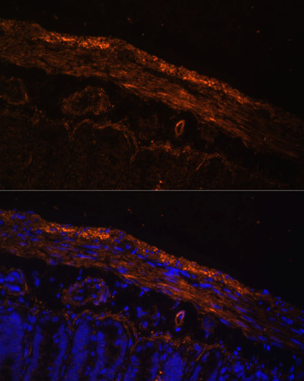MYL9 Rabbit polyclonal antibody