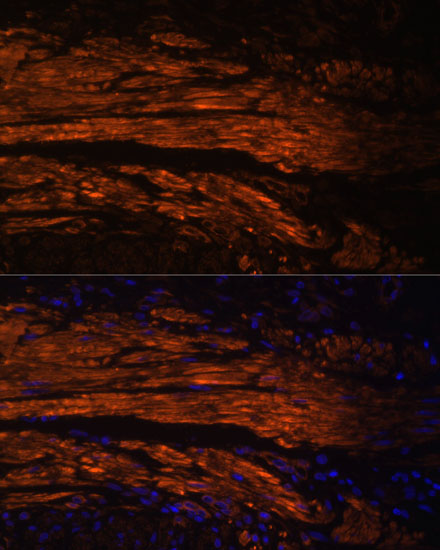 MYL9 Rabbit polyclonal antibody