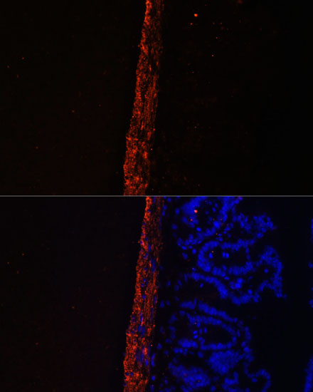 MYL9 Rabbit polyclonal antibody