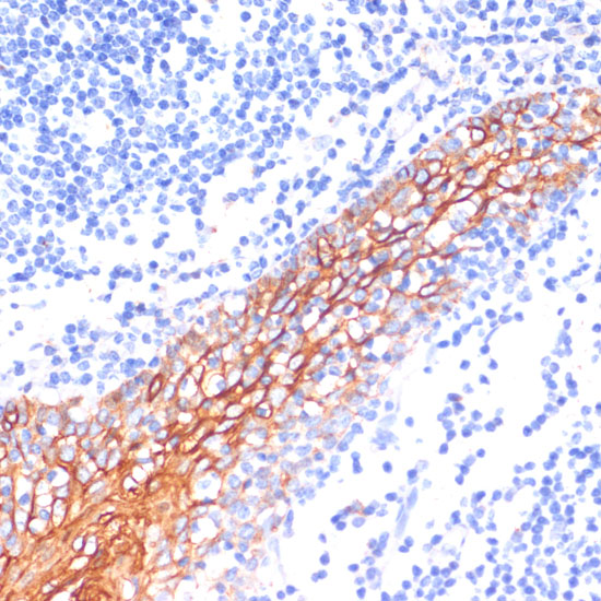 E-Cadherin Rabbit polyclonal antibody