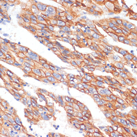 E-Cadherin Rabbit polyclonal antibody