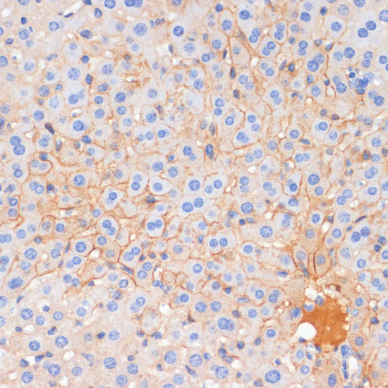 E-Cadherin Rabbit polyclonal antibody