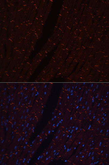 N-Cadherin Rabbit polyclonal antibody