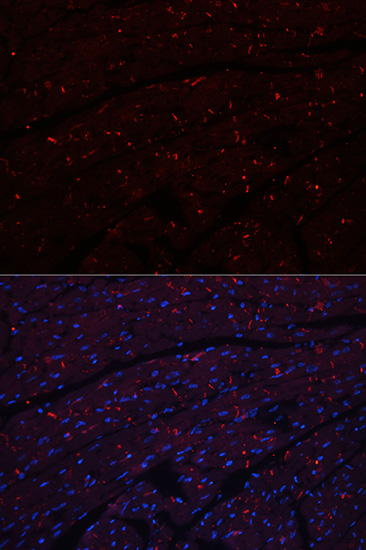 N-Cadherin Rabbit polyclonal antibody