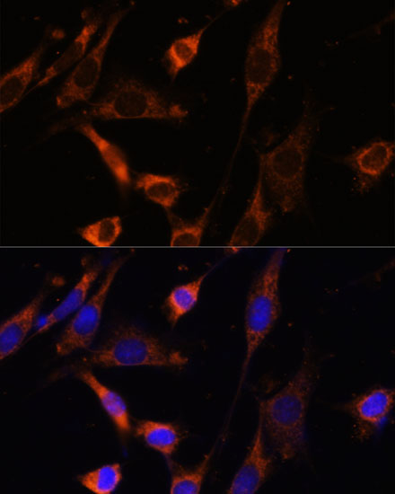 CKMT1B Rabbit polyclonal antibody