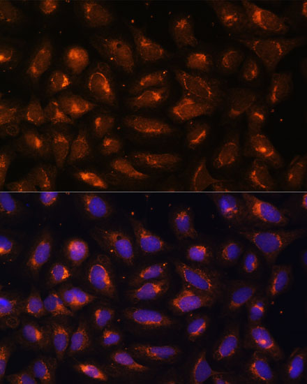 CKMT1B Rabbit polyclonal antibody