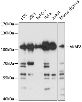 AKAP8 Rabbit polyclonal antibody