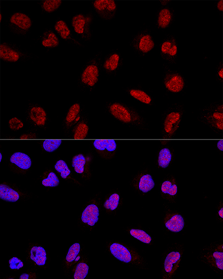 AKAP8 Rabbit polyclonal antibody