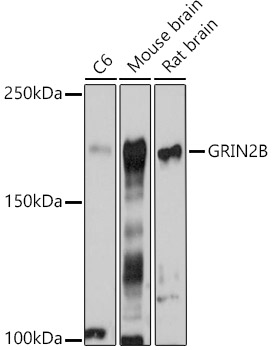 GRIN2B Rabbit polyclonal antibody