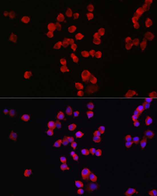 GRIN2B Rabbit polyclonal antibody