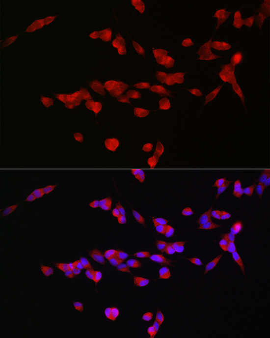 GRIN2B Rabbit polyclonal antibody