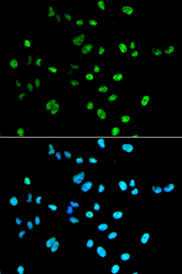 PAX2 Rabbit polyclonal antibody