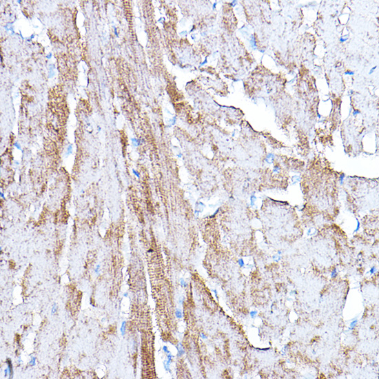 PDK4 Rabbit polyclonal antibody