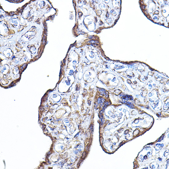 PDK4 Rabbit polyclonal antibody