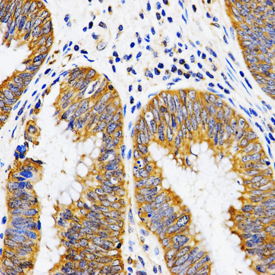 PIBF1 Rabbit polyclonal antibody