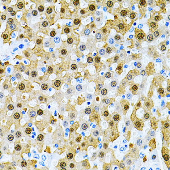 PIBF1 Rabbit polyclonal antibody