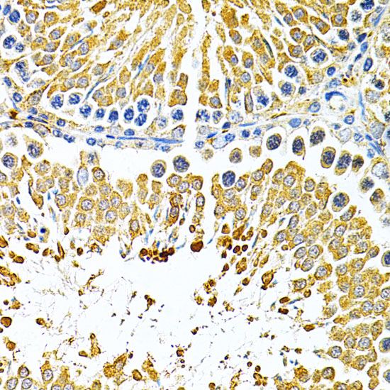 PIBF1 Rabbit polyclonal antibody