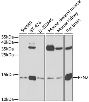 PFN2 Rabbit pAb