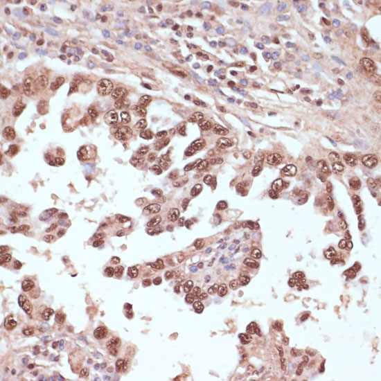 Rad50 Rabbit polyclonal antibody
