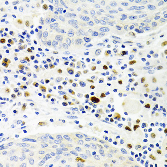 Gemin 2 Rabbit polyclonal antibody