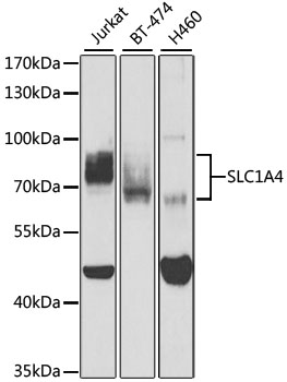 SLC1A4 Rabbit polyclonal antibody