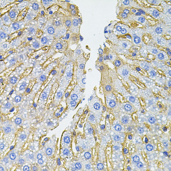 SLC1A4 Rabbit polyclonal antibody
