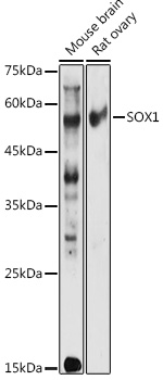 SOX1 Rabbit polyclonal antibody