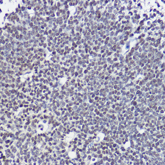 SOX1 Rabbit polyclonal antibody