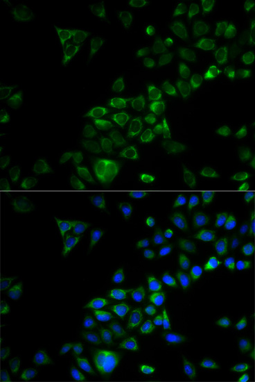 TRAF3 Rabbit polyclonal antibody