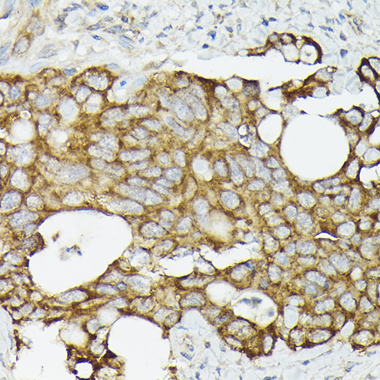 TRAF7 Rabbit polyclonal antibody