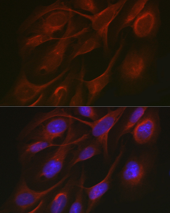 TRAF7 Rabbit polyclonal antibody
