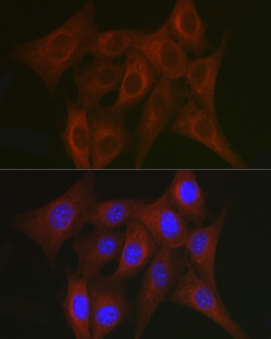 TRAF7 Rabbit polyclonal antibody