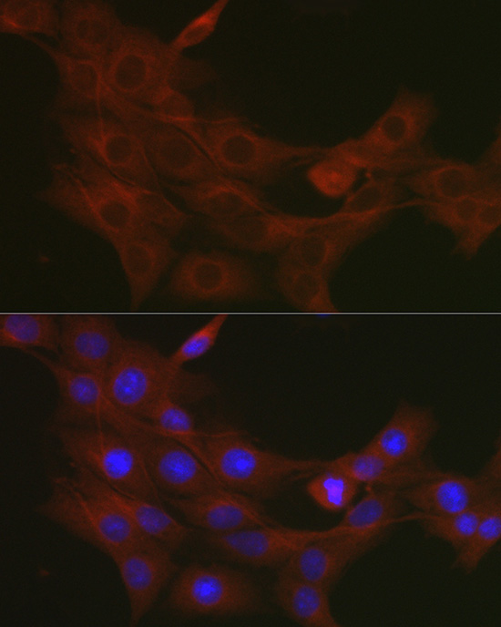 TRAF7 Rabbit polyclonal antibody