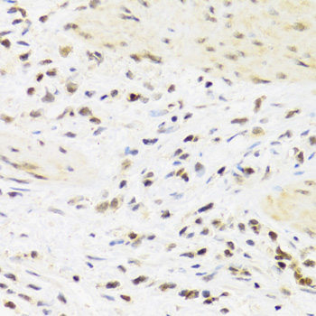 SUMO4 Rabbit polyclonal antibody