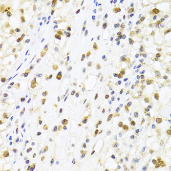 SUMO4 Rabbit polyclonal antibody