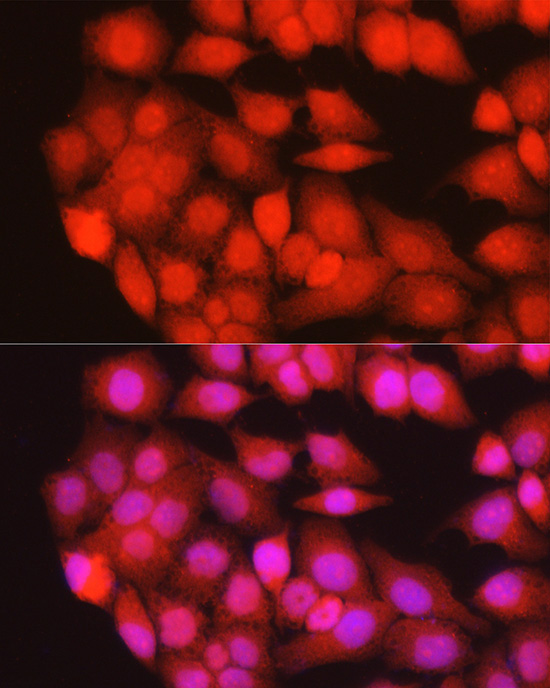 TRIM63 Rabbit polyclonal antibody