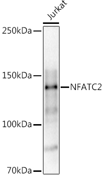 NFATC2 Rabbit polyclonal antibody