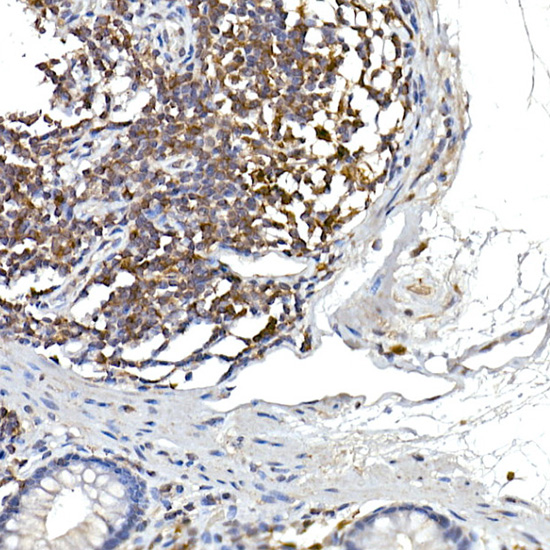NFATC2 Rabbit polyclonal antibody