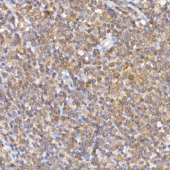 NFATC2 Rabbit polyclonal antibody