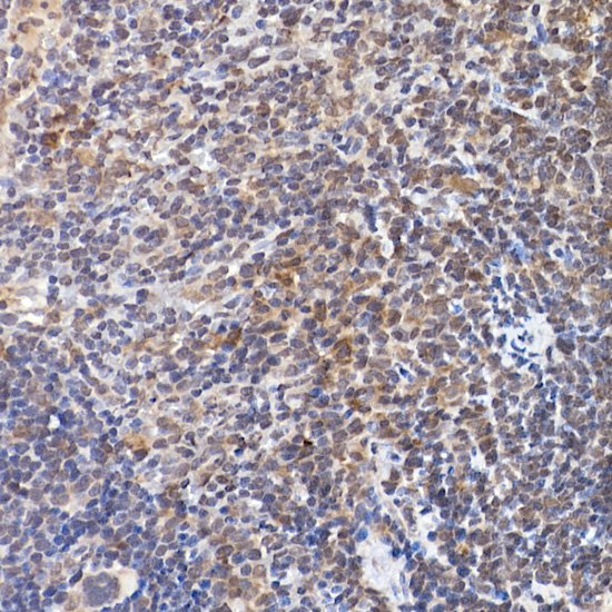 NFATC2 Rabbit polyclonal antibody