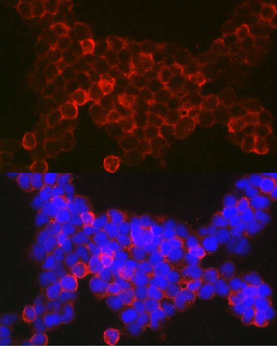 NFATC2 Rabbit polyclonal antibody