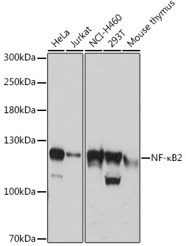 NF-K KappaB2 Rabbit polyclonal antibody