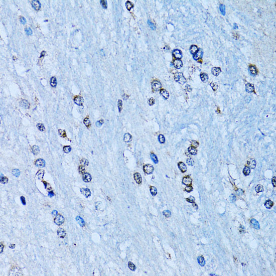 NF-K KappaB2 Rabbit polyclonal antibody