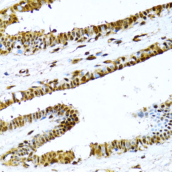 NF-K KappaB2 Rabbit polyclonal antibody