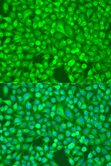 NF-K KappaB2 Rabbit polyclonal antibody