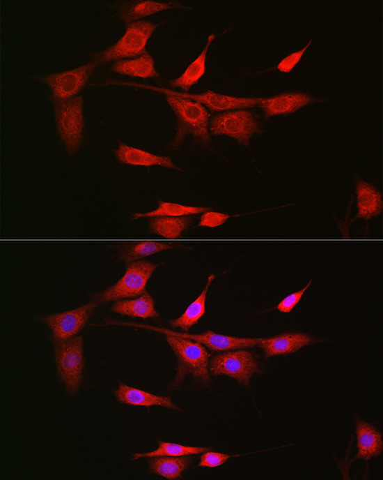 NOTCH3 Rabbit polyclonal antibody