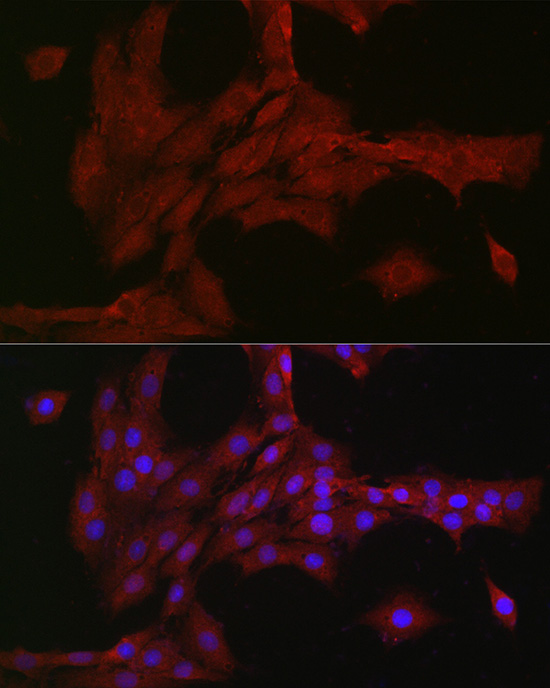 NOTCH3 Rabbit polyclonal antibody