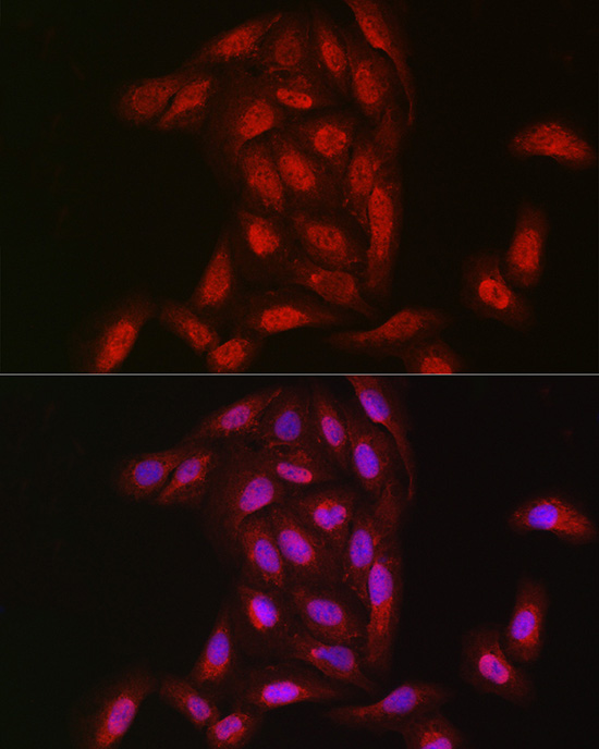 NOTCH3 Rabbit polyclonal antibody