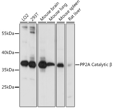 PP2A Catalytic B Beta Rabbit polyclonal antibody
